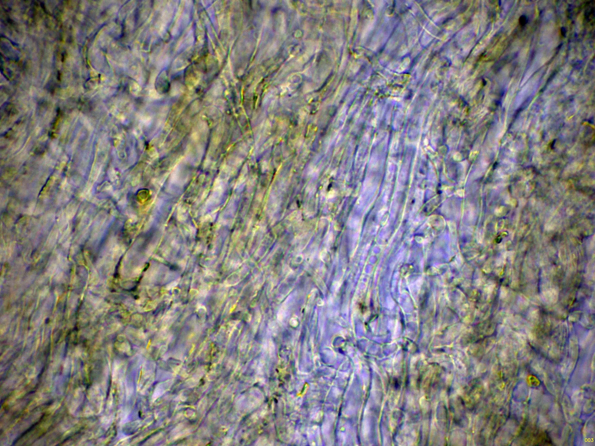 Microscopía de Tolypocladium capitatum - 10 - Contexto agua-003